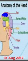 Migraine Pic screenshot 2