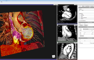 Vesalius3D screenshot 2