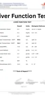 Liver Function Test Report Sample