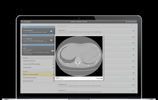 Orthanc screenshot 1