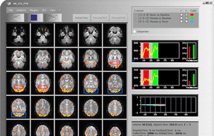 Turbo-BrainVoyager screenshot 1