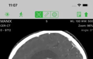 OsiriX screenshot 1