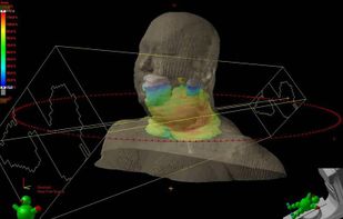 Varian Eclipse screenshot 1