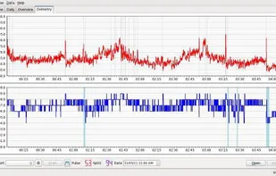 SleepyHead screenshot 1