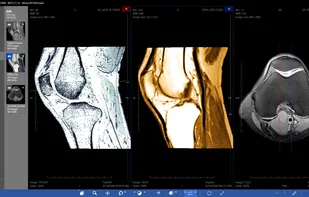 Athena DICOM Viewer screenshot 1
