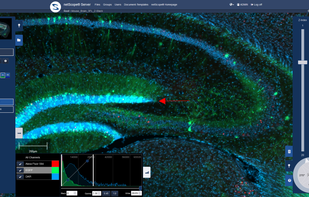 Integrated web-viewer to view slides with their annotations, channels, label, and many more additional information.