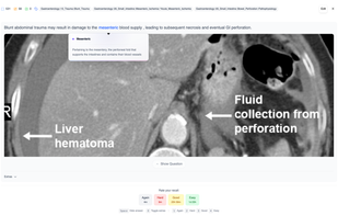 Enhance generated cards or imported decks with keyword highlighting - all done automatically