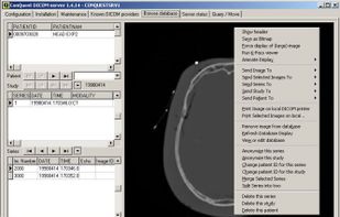 ConQuest DICOM server screenshot 1
