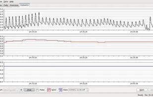 SleepyHead screenshot 1