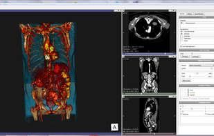Vesalius3D screenshot 1