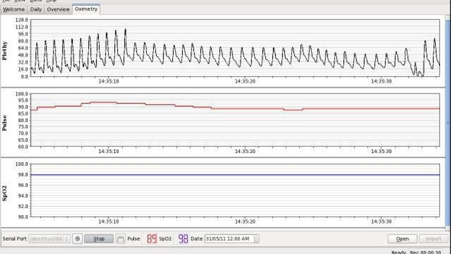 oscar cpap software download