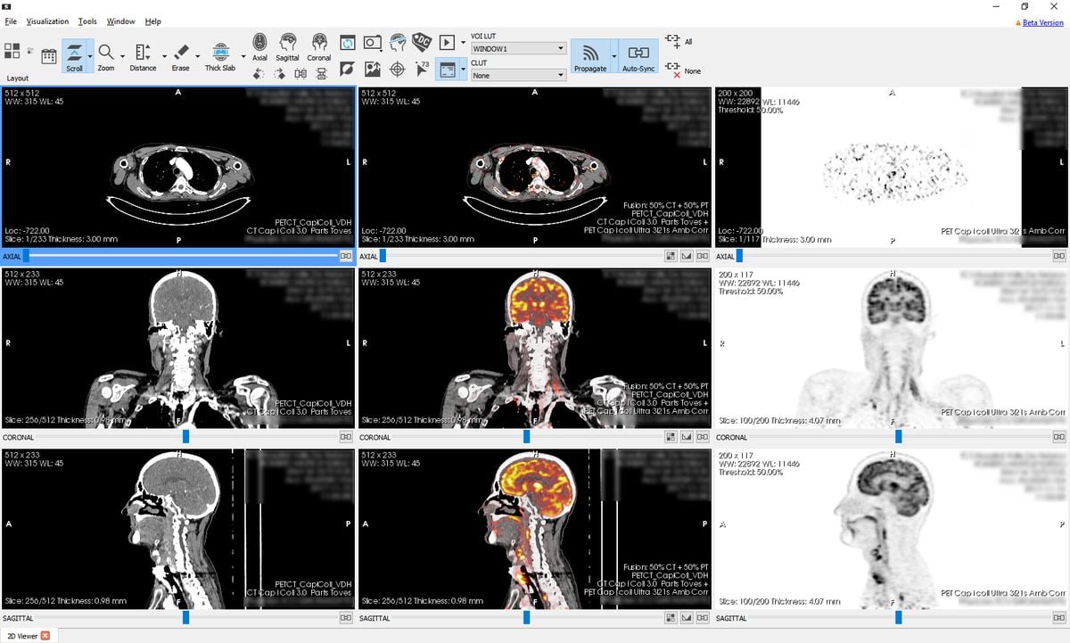 Starviewer app reviews features pricing download alternativeto
