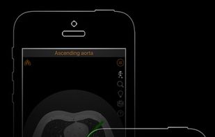 CT Anatomy screenshot 2