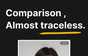 PicInpaint - AI Photo Eraser screenshot 1