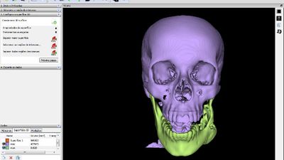 3D mesh