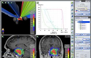 iPlan RT screenshot 1