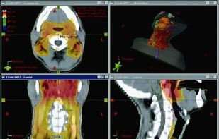 Varian Eclipse screenshot 1