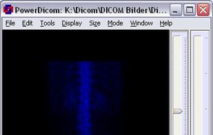 PowerDicom screenshot 2