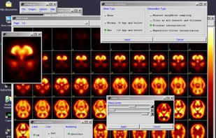 xMedCon screenshot 1