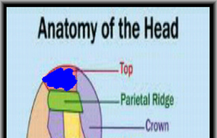 Migraine Pic screenshot 1