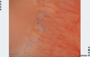 Capillary.io screenshot 1