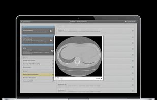 Orthanc screenshot 1