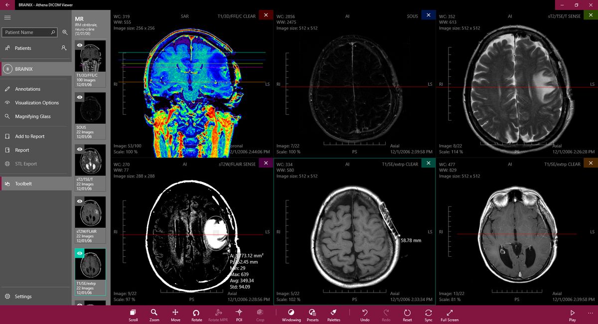 free dicom viewer with dual monitor display