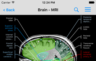 e-Anatomy screenshot 1