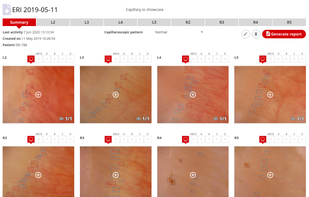 Capillary.io screenshot 1