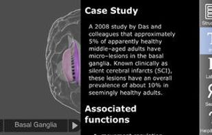 3D Brain screenshot 2