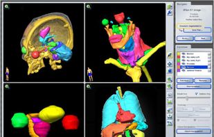 iPlan RT screenshot 2