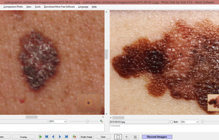 Photo Side-by-Side screenshot 1