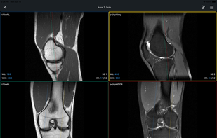 IDV - IMAIOS DICOM Viewer screenshot 3