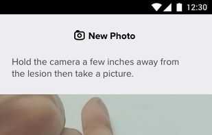 1. Take an image of a lesion.