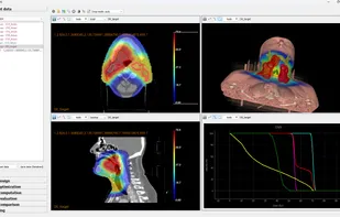 OpenTPS screenshot 1