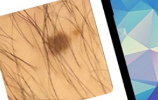 HealthAI screenshot 2