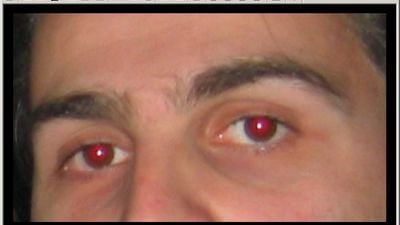 Redeyes