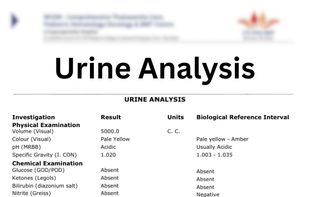 Urine Analysis Report Sample