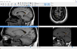 Starviewer screenshot 3