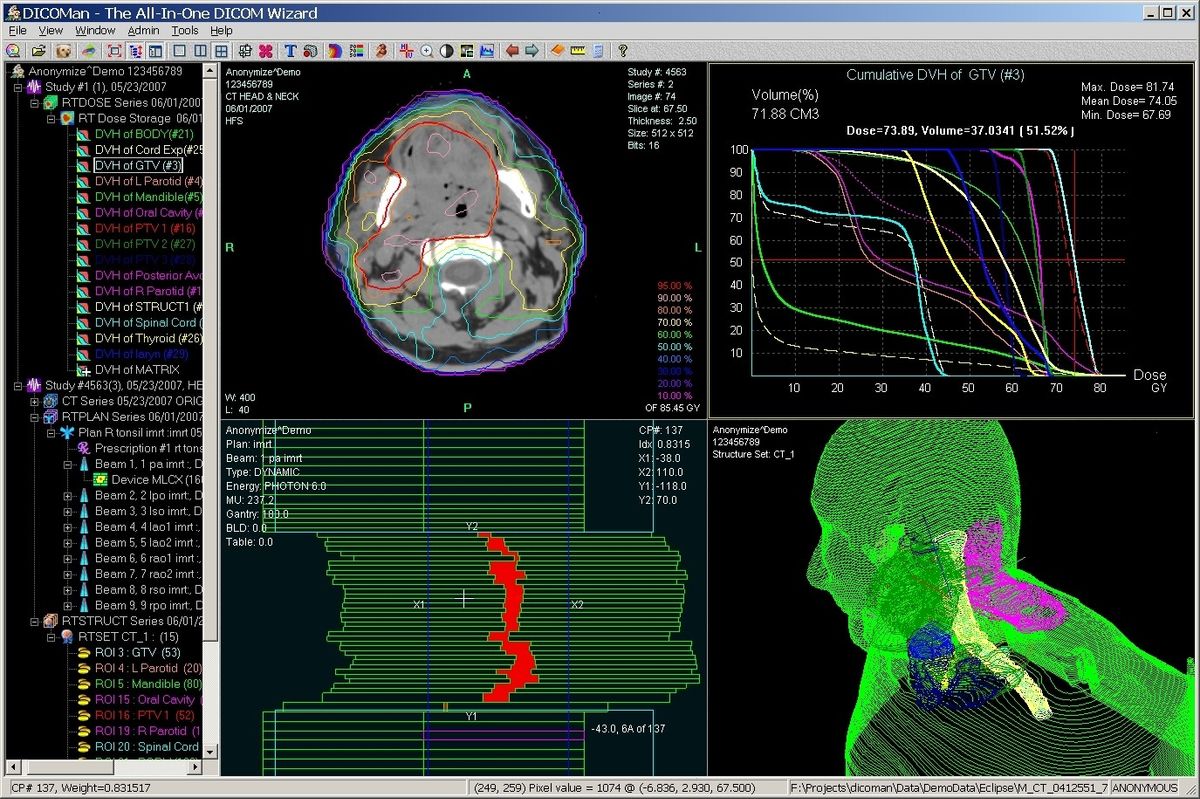 Radiant dicom viewer crack. Симуляция Dicom. Radiant Dicom viewer. MICRODICOM viewer. Weasis.