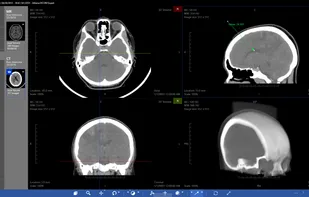 Athena DICOM Viewer screenshot 2