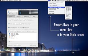 Pauses' configuration window