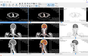 Starviewer screenshot 1