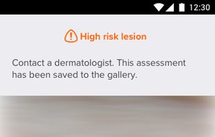 2. Detect health risk by assessing lesion with AI.