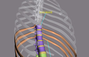 Costae spuriae and thoracic vertebrae