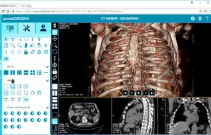 Viewing 3D & MPR Functions 