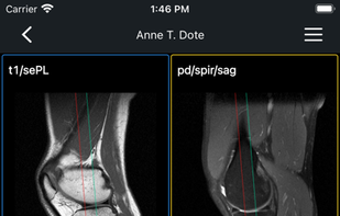 IDV - IMAIOS DICOM Viewer screenshot 2