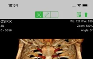 OsiriX screenshot 1
