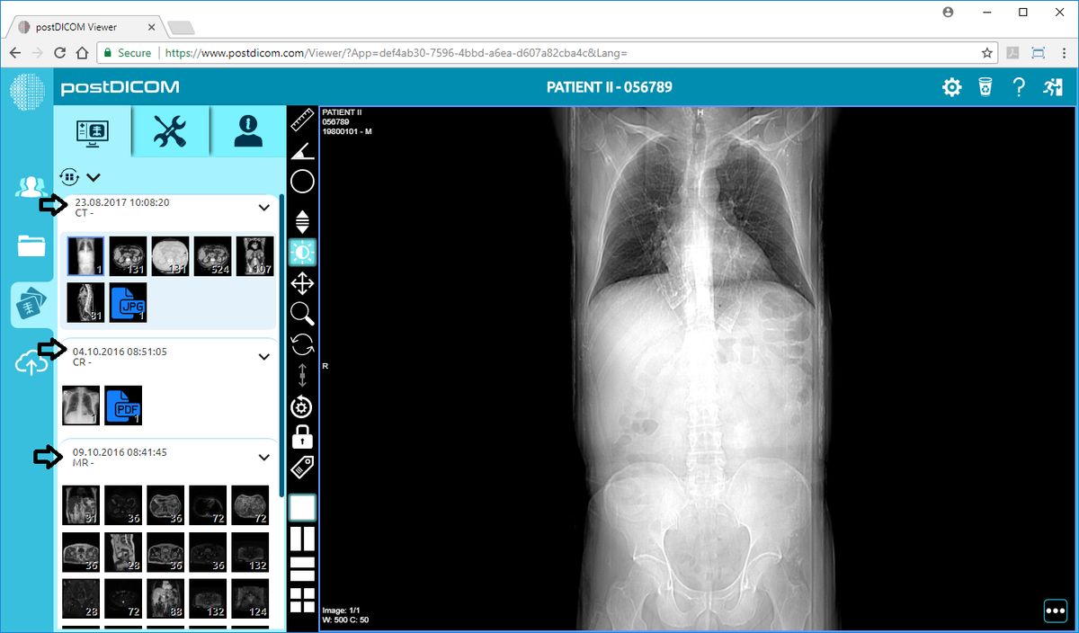free dicom viewer ant free dicom viewer ant