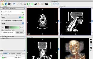 Multislice view and Volume Rendering